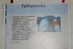 Подробнее: Всемирный день борьбы с туберкулезом